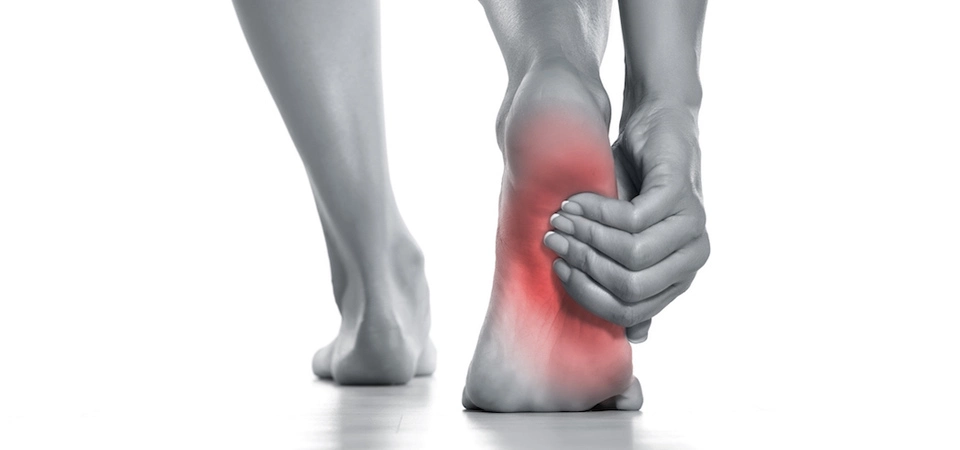 Plantar Fasiit'te (Topukta Ağrı) Nöralterapi Plantar fasiit, topuktan ayak tabanına uzanan plantar fasyanın diğer adıyla tendon plakasının ağrılı bir enflamasyonudur.